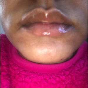 Lip gloss(lip Glow discoloration treatment natural